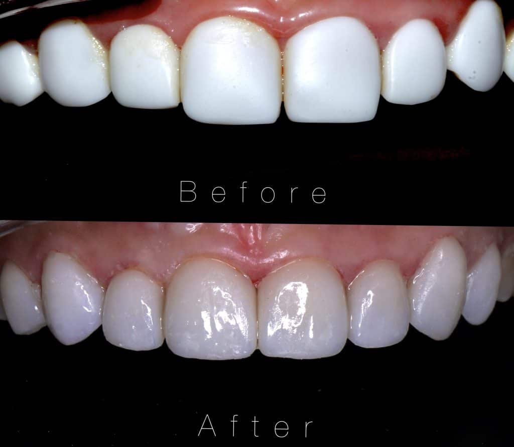 Processed with MOLDIV