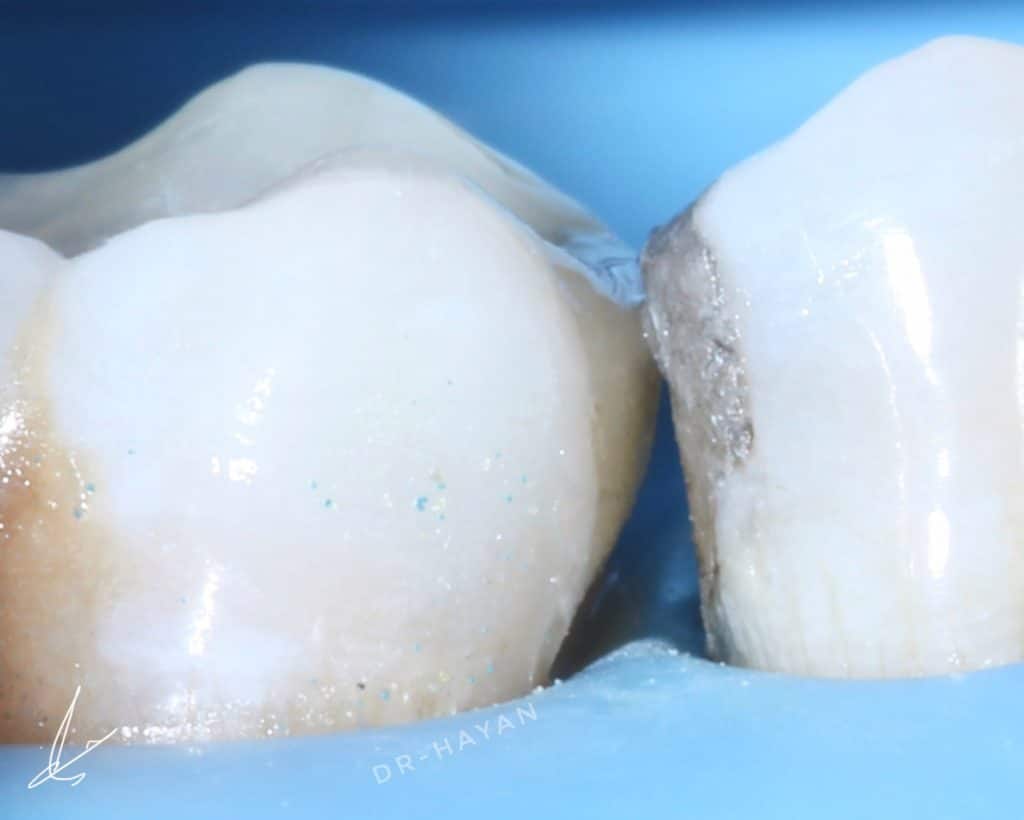 42501CD7-7B9F-4FAB-B2B2-E8262EEFC9D6