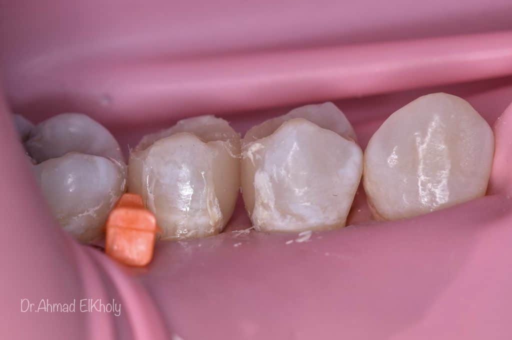 44A4BAF7-B84B-45C1-8163-3E76825FB08F