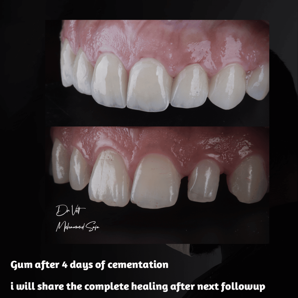 44DD8F39-ED6D-4D29-9228-2D22B84EBAF7