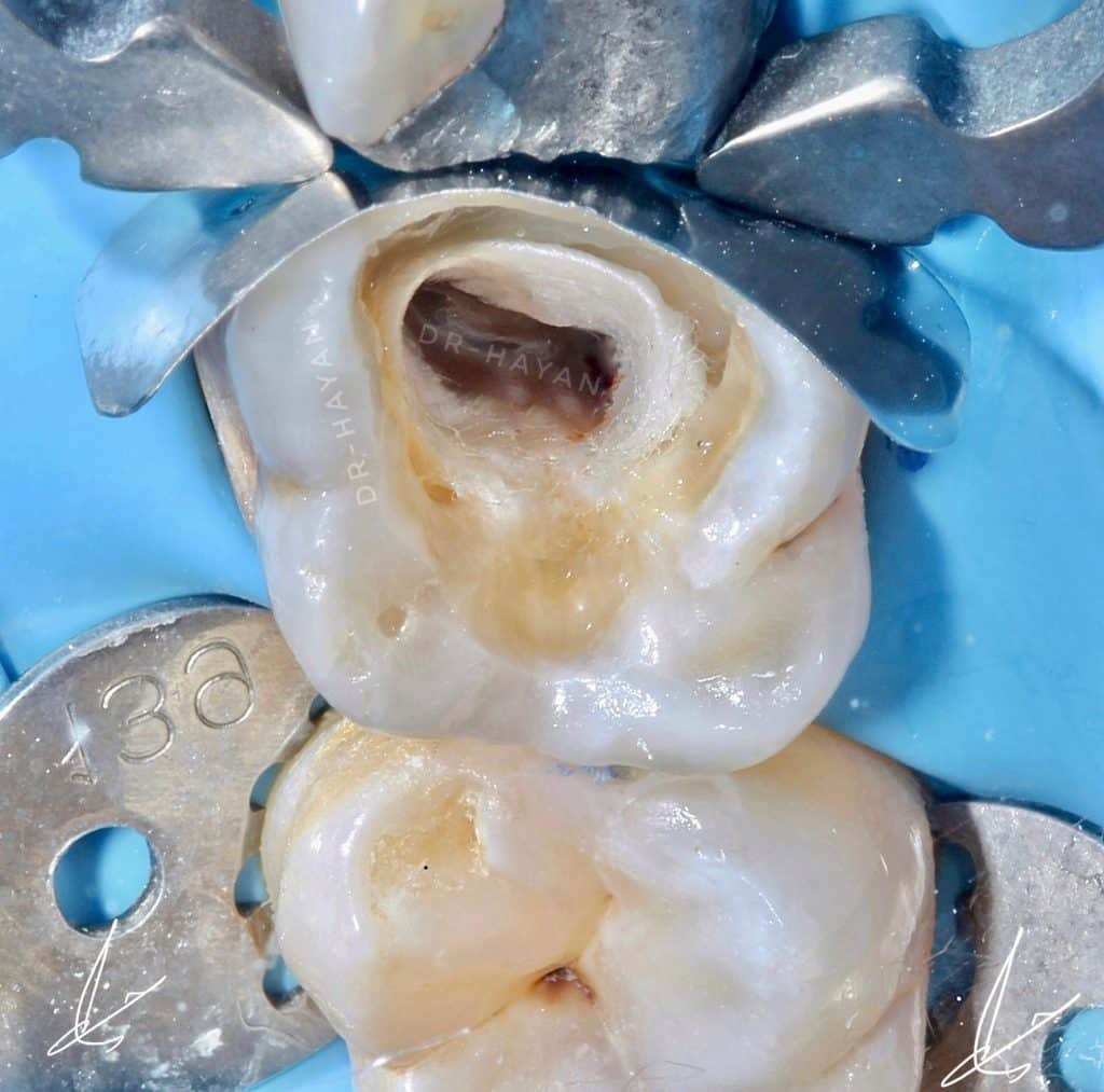 52547F00-1EA3-4B1E-B6A1-8A44F6214020