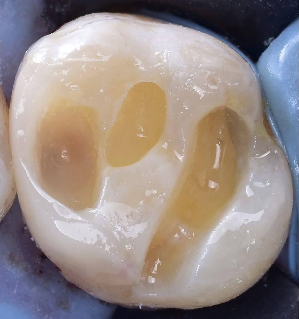 562700BA-E2A7-4394-8962-21947DBD87C0