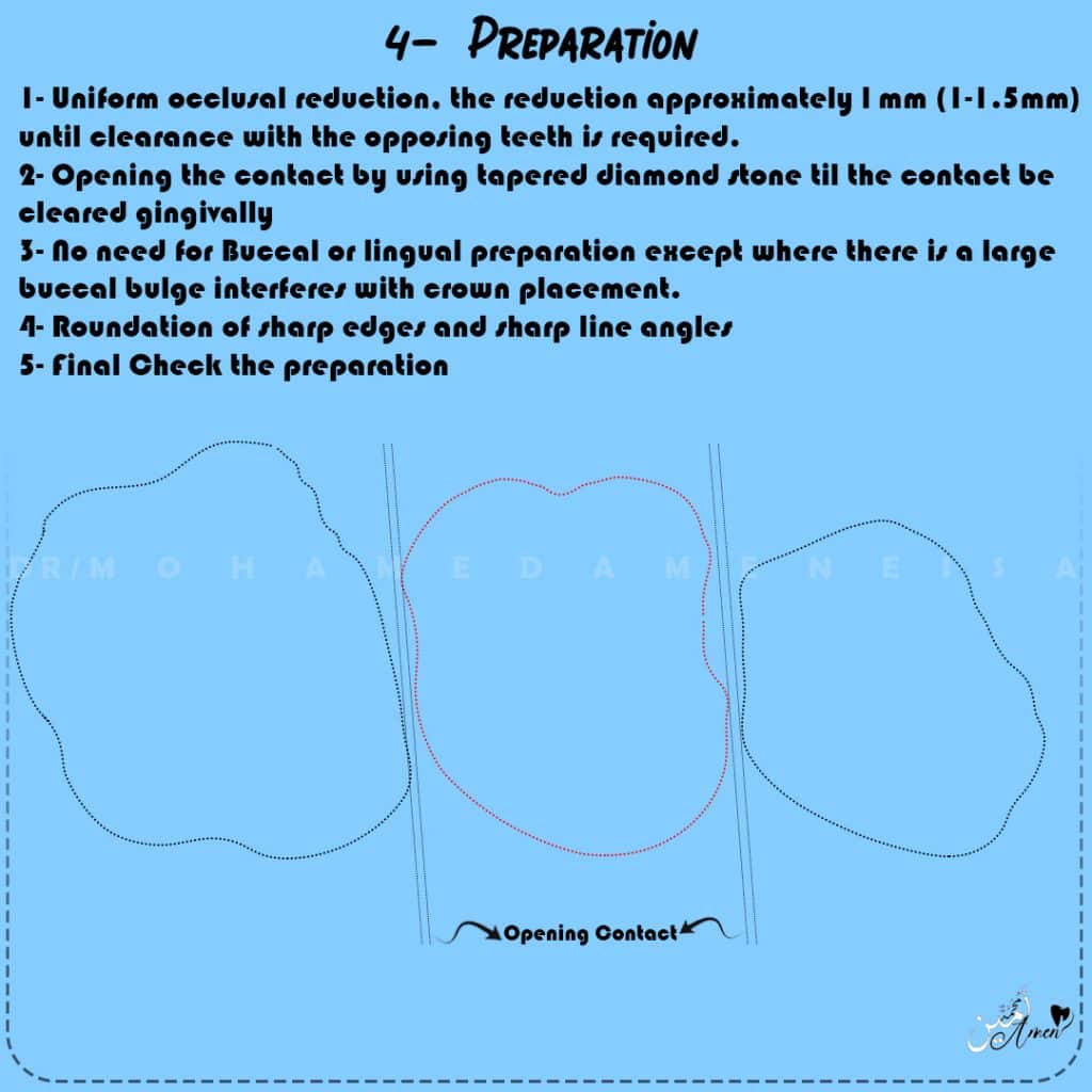7- Preparation 3