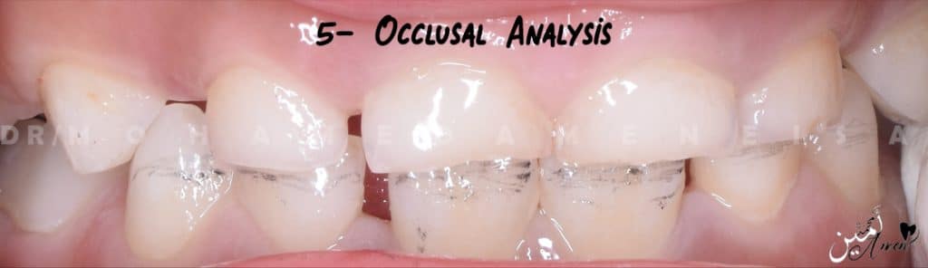 9- Occlusal Analysis