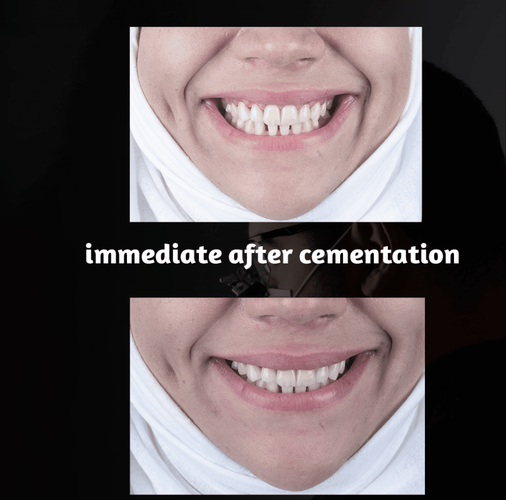 A217E6BC-9C09-49A1-829A-8A40753AA8B4