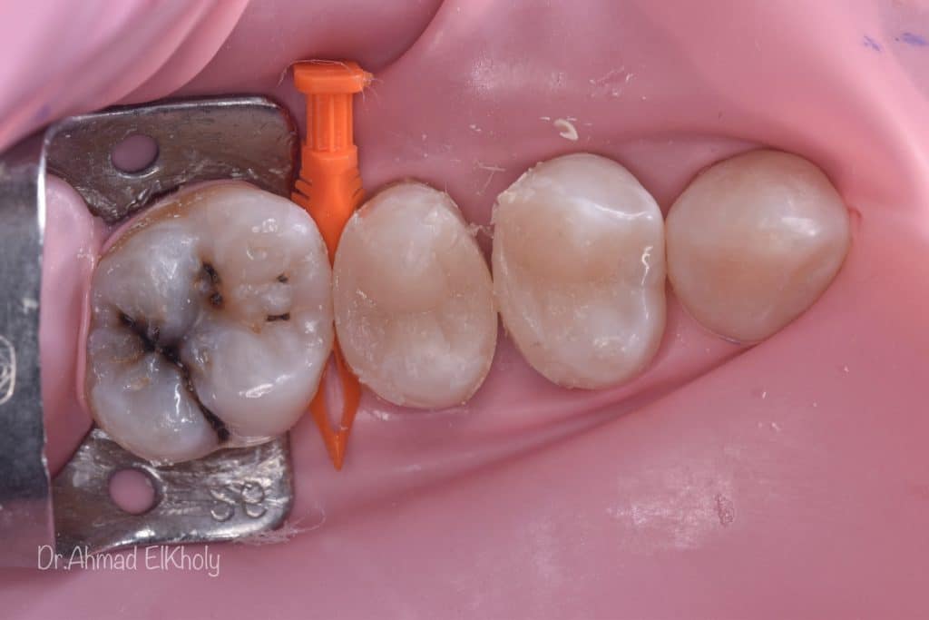 A2DD8003-8101-45CF-AB99-AC3196F2AF72