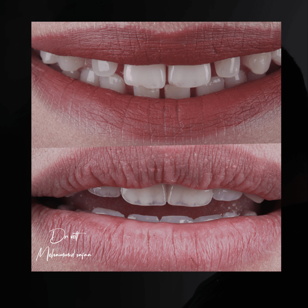 A3CEAC49-230D-4993-9691-4CAB5765B066