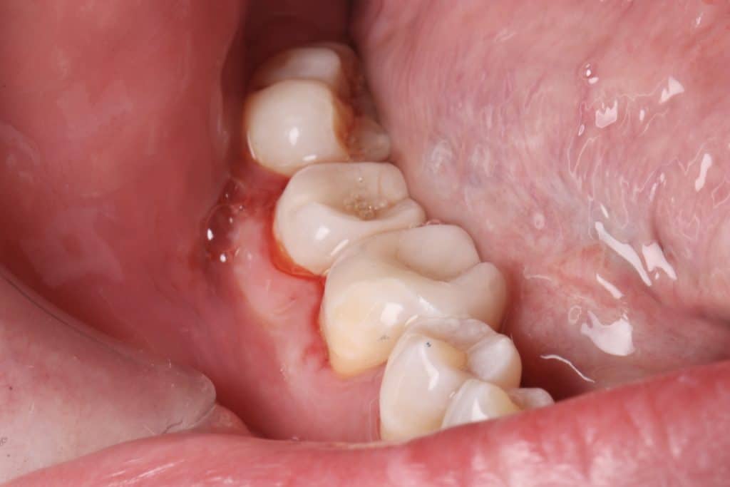 A6DF267F-E8B9-4078-BA3C-0A5CB9063FFF