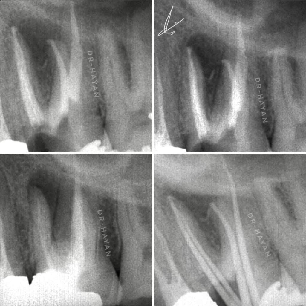 C3D855C4-7B70-4592-8A19-772719D19CE7