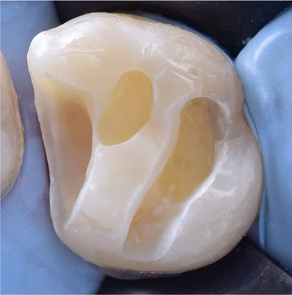 C5C29B8F-15B7-4608-B4F9-9A4240D7F375