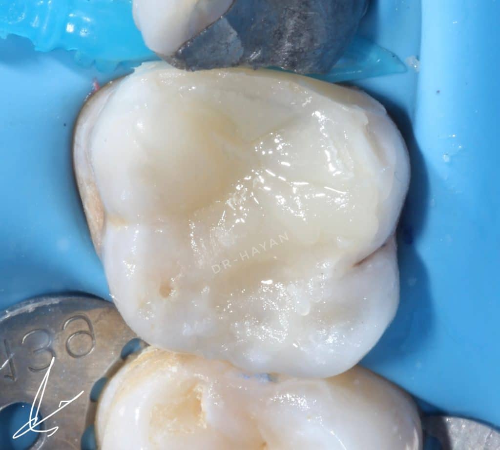 CC8576E1-3464-4DB3-9B31-1017C4686AA1