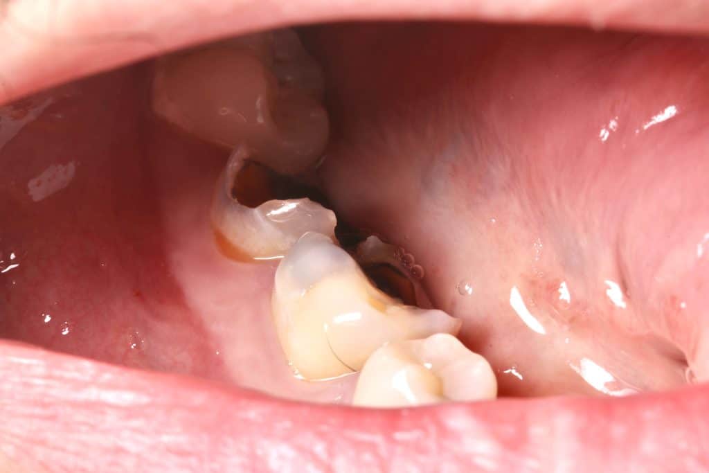 D9C5FDA7-52B0-49A2-BF7C-98135371D944