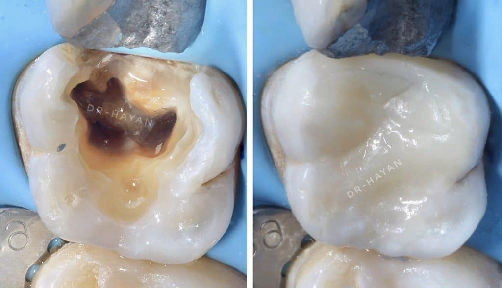 DBEC0794-C942-4A83-9BFB-E5C6E4A6C9B3