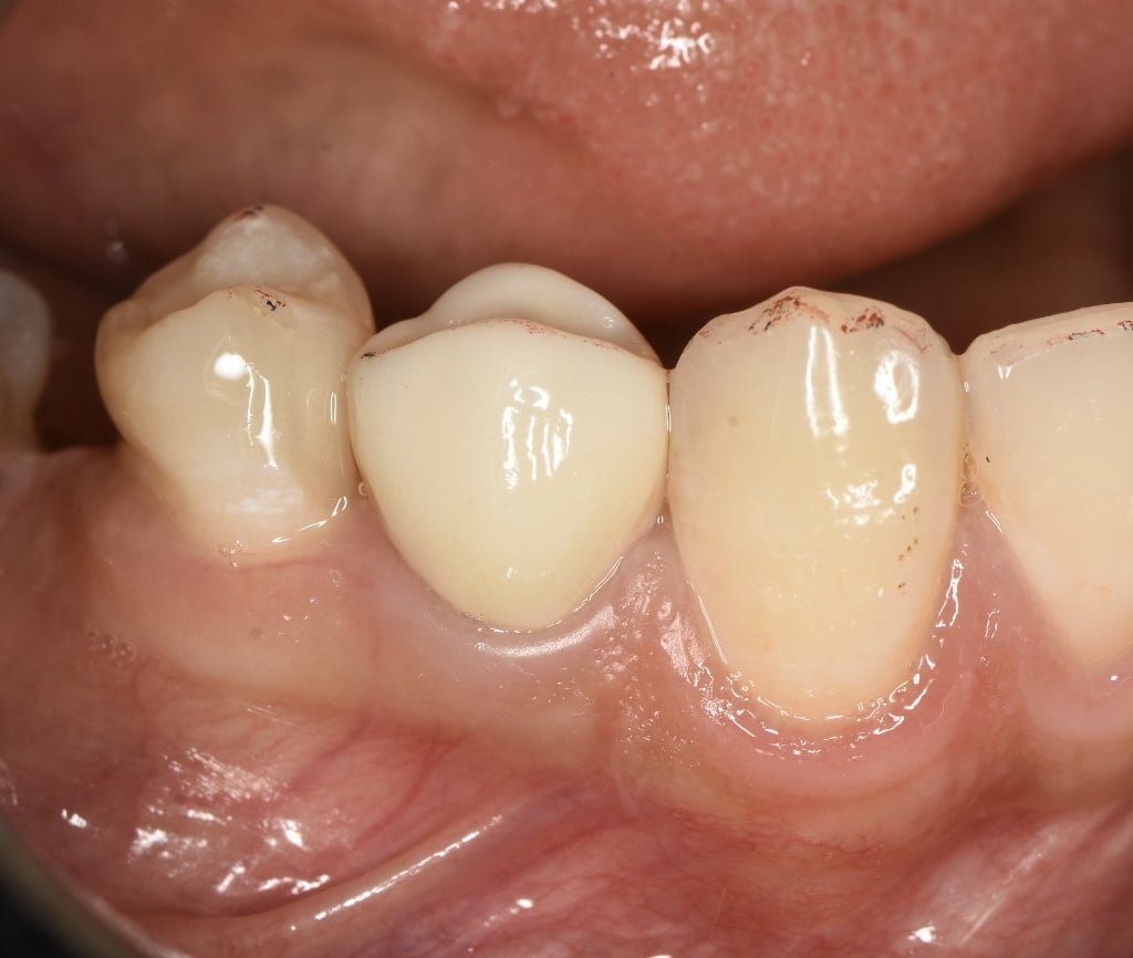 DEA5C98E-D8AD-4610-B4E0-E41D06A56B4E