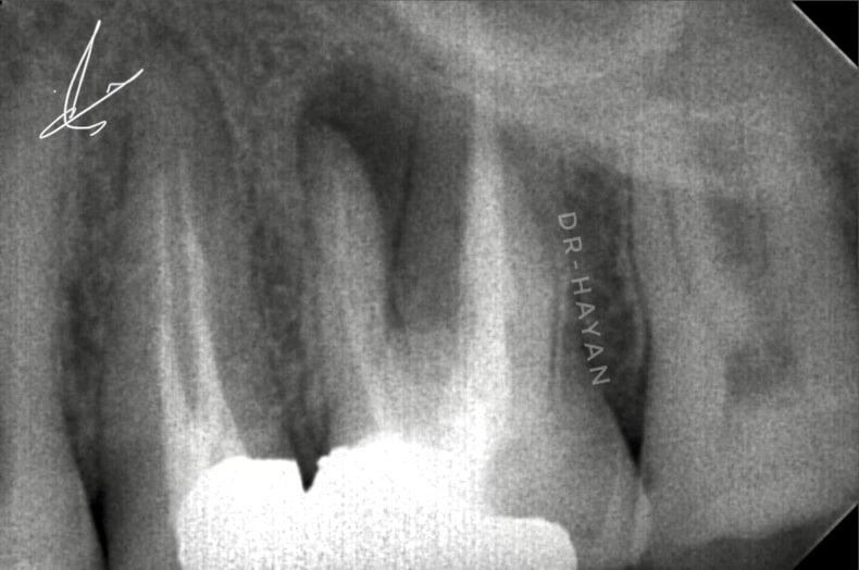 DFBFE2B9-0812-4919-BA66-B5FF345632BC