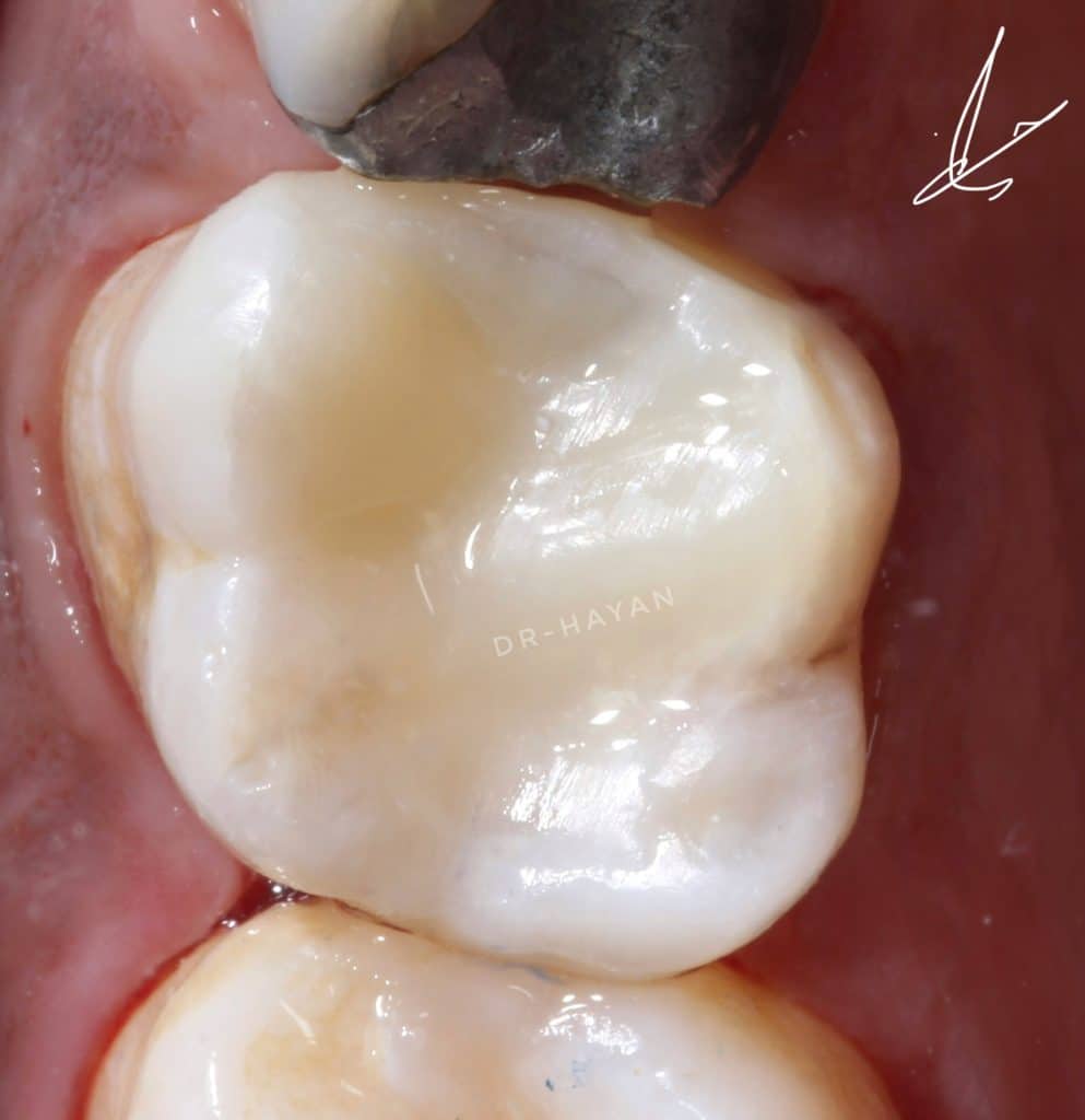 E34B5854-4667-4129-90B7-2F6EDAE34A39