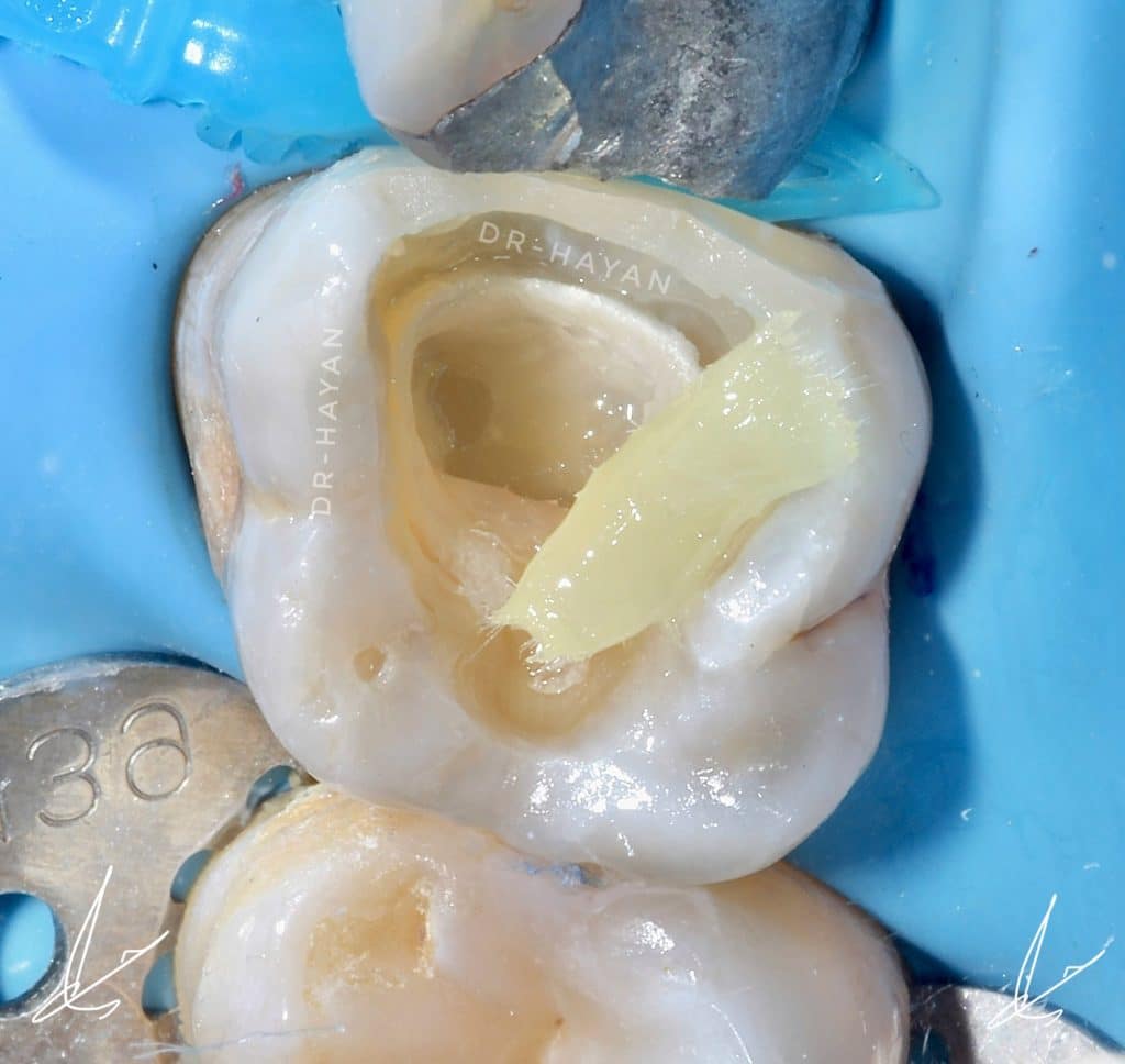 E9515A98-82CD-4897-9B95-F00B886FC2A3