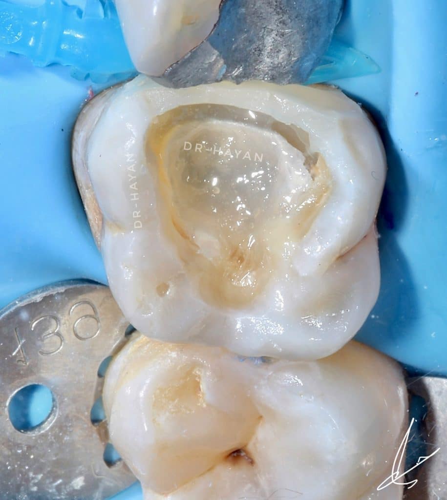 F1B0C896-6B75-4F84-9DFF-29E2C4E5923D