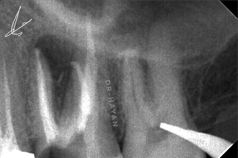 F6846707-BAD8-421C-B6BC-0C0500F59A83