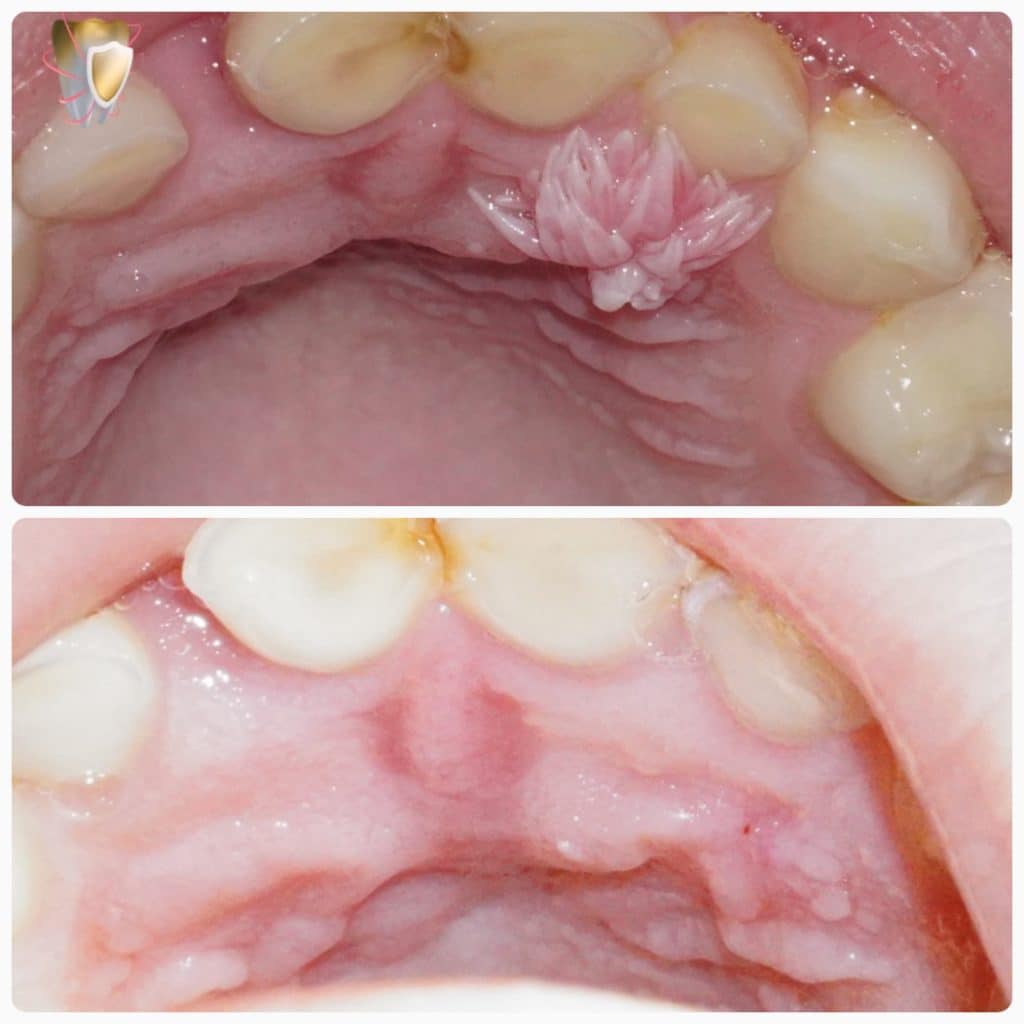 PhotoGrid_1_20230222090228