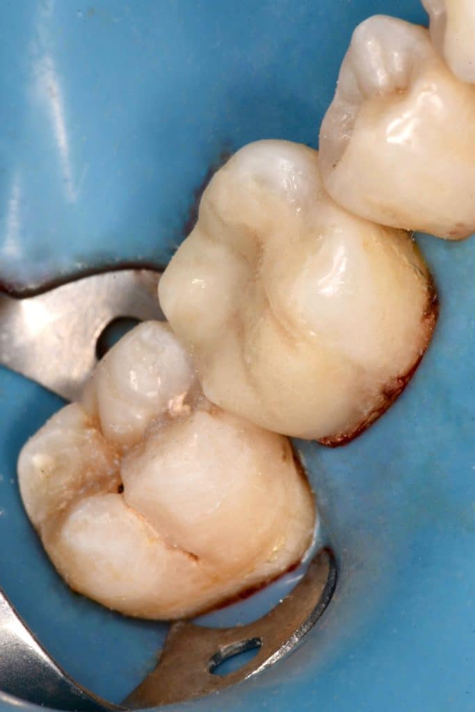 1184DE67-49CD-4399-AC02-8AC3FF71CBA0