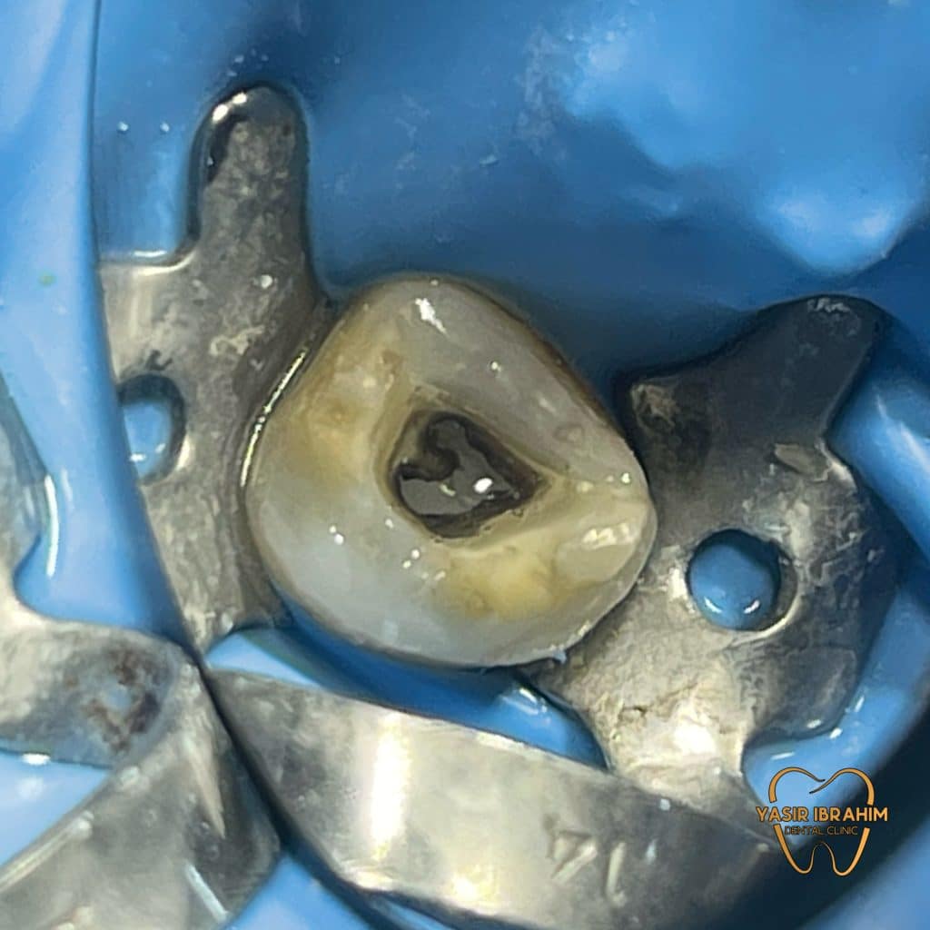 16891EEB-71A9-4945-8A54-2572BB61CB8A