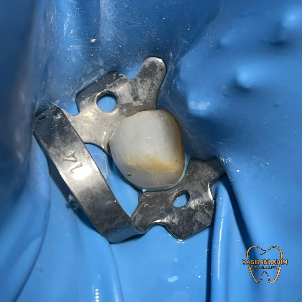 222AD65E-F76A-4B31-961A-F6AD0DACFA55