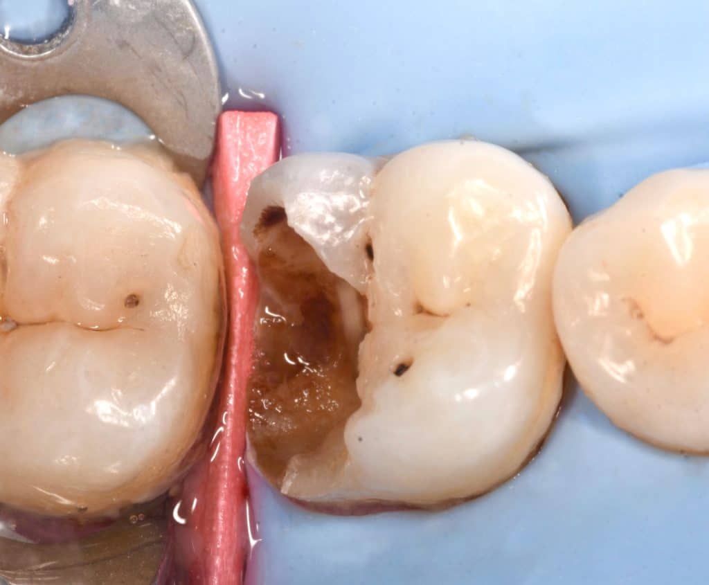 36CFC818-8886-4342-A571-4F1046C57B11