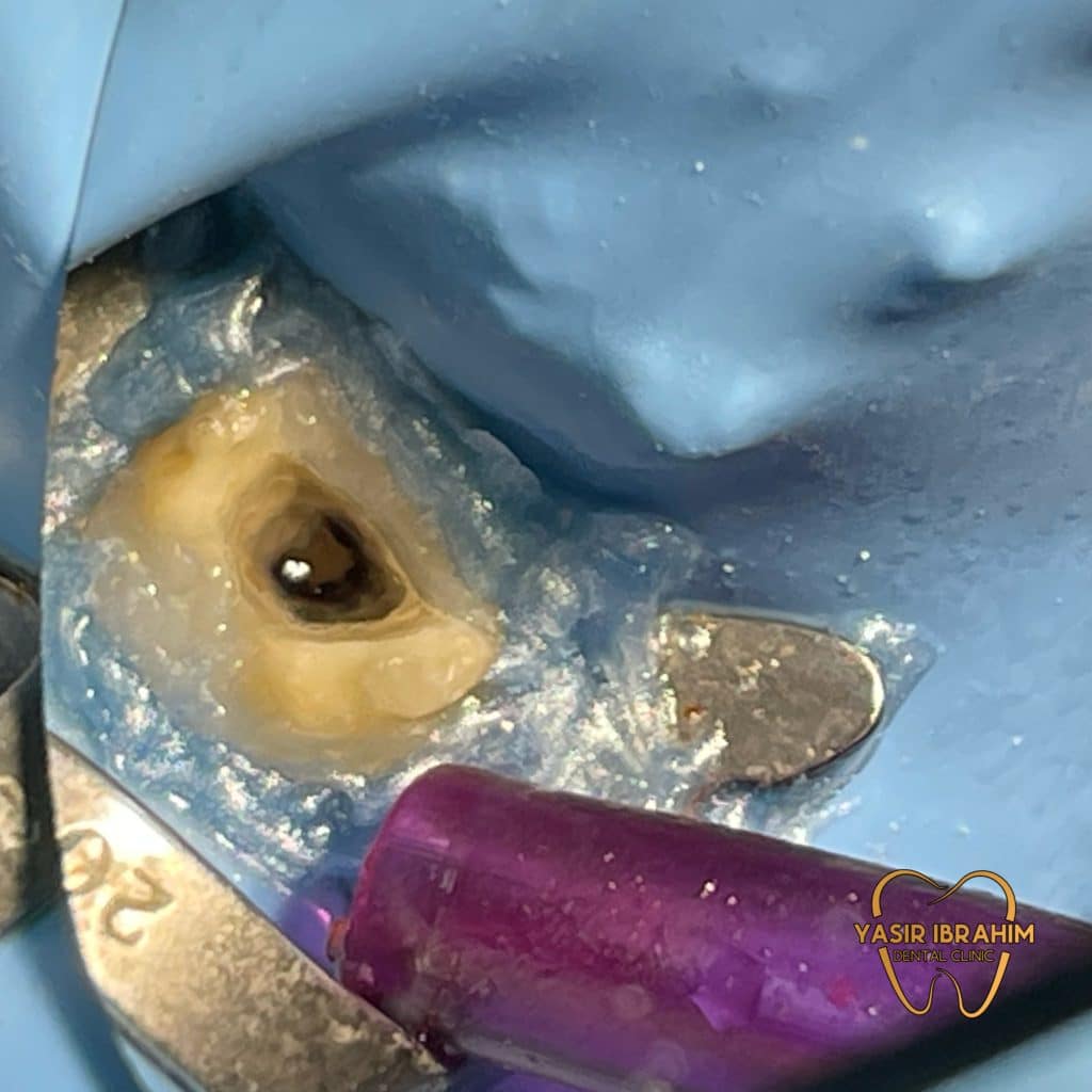 3A6A7E7E-8C1E-45F5-A173-F00AB77CF9D9