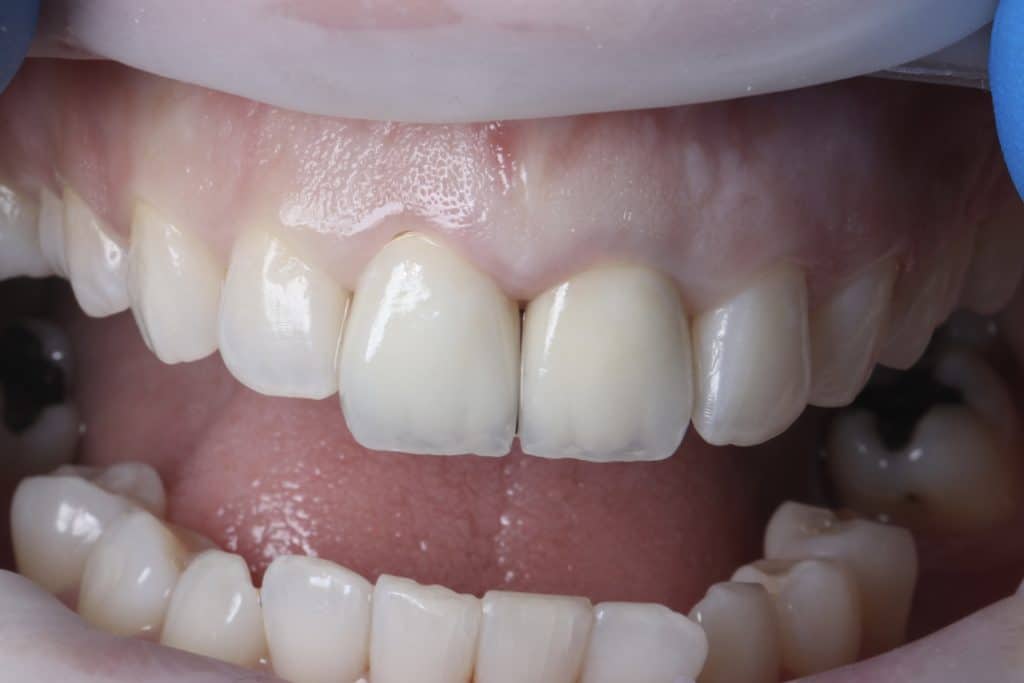 4D2F24AB-DE11-4DBE-9FB5-3968F16ADFC1