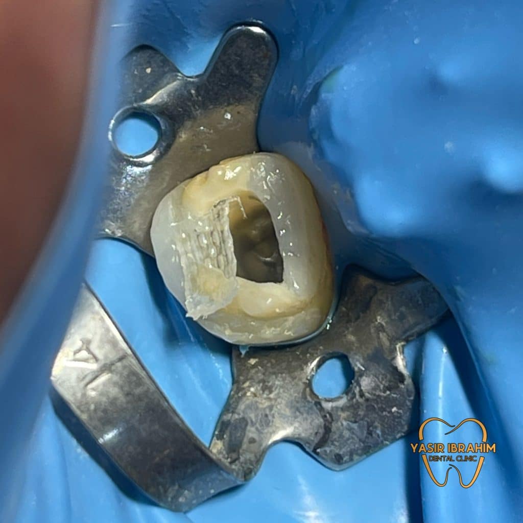 59B24DEB-68F4-42A2-854A-85EEDEB87D67