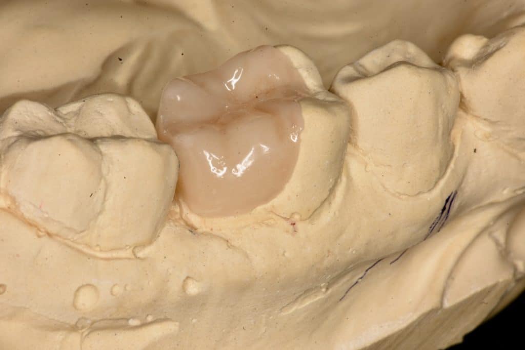 82F481DF-C65A-4A81-8CD7-11A964A9398A