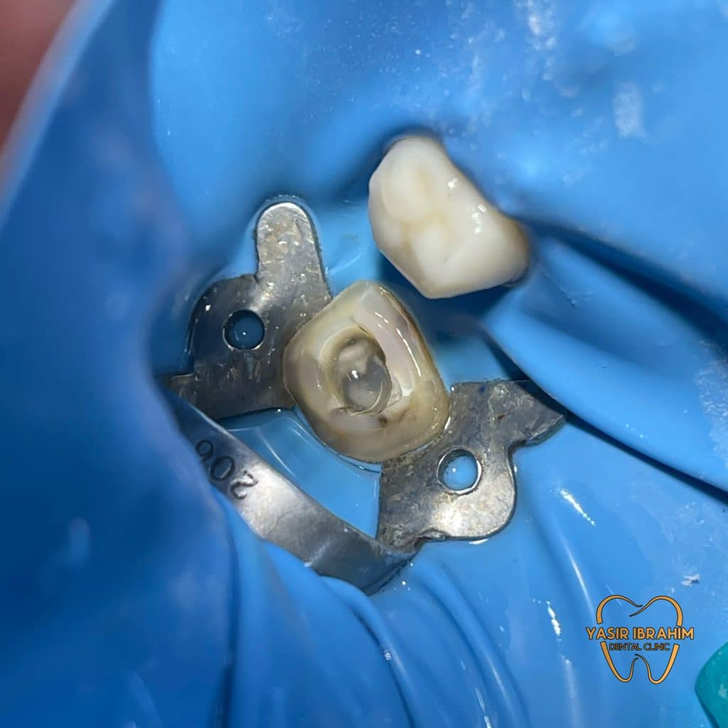 900F95F3-923B-4EC7-B390-AE84FBF425D1