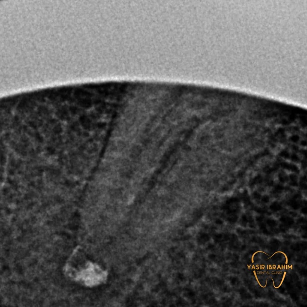 90BD958E-BC7D-4B57-AE95-3CE1FCF1849E