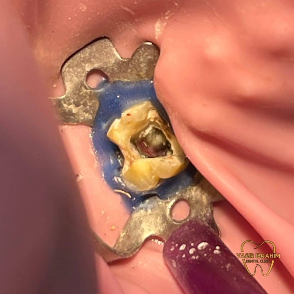 92F14D88-F88A-42FC-ABDF-35BC3DE6D64C