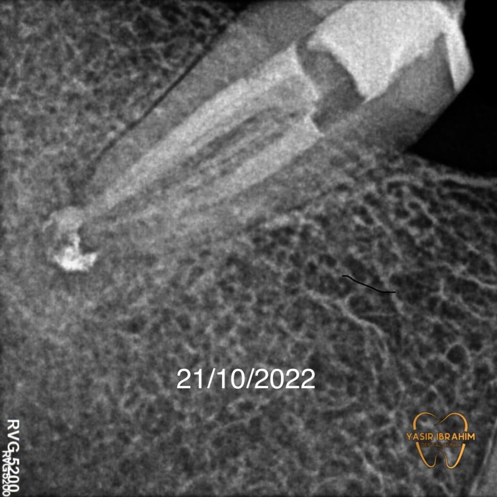 95EF7FFE-DA28-4BED-8930-92CEF5CED03E