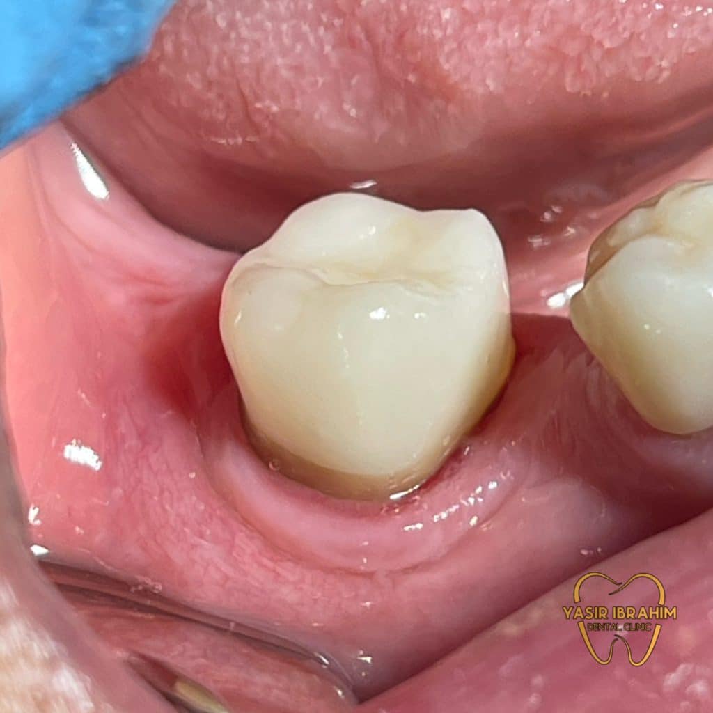 96EFB845-A99A-4DA5-A228-E358C6F4201B