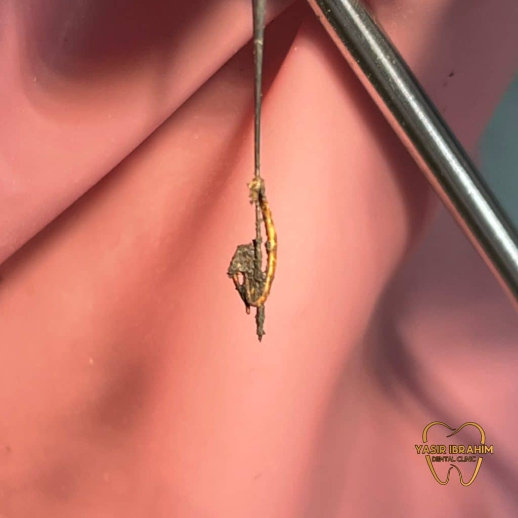 A4DE03BB-1B8F-4C1B-8801-89EBD862607D