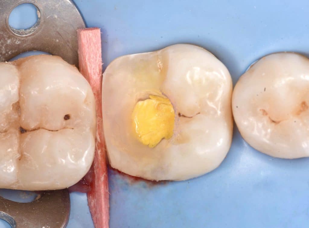 A8ADEE51-2806-41DA-B164-F34918B20711