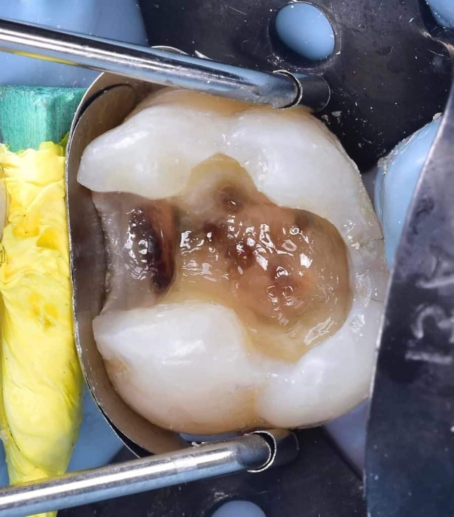 C23111AD-254D-4BFF-9B3C-87FDB04275E9