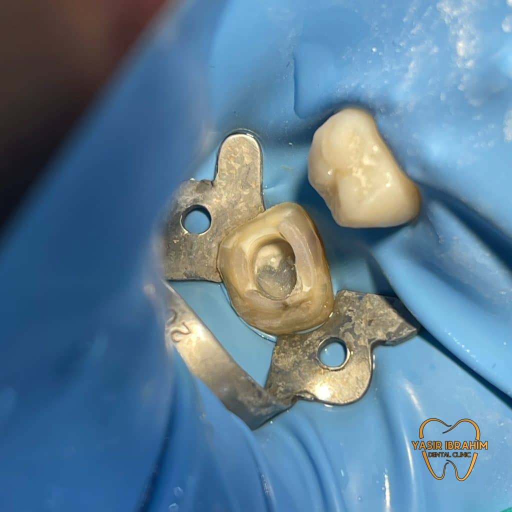 D66D3623-BC51-42D1-8314-44F67F6058A2