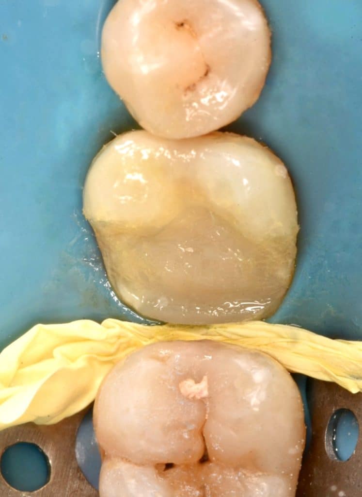 E60CA801-DD59-460A-BE56-0667E780880A