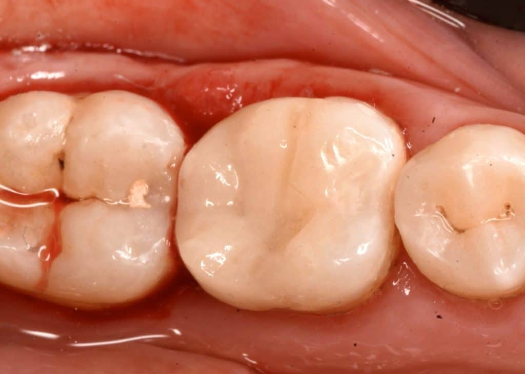 EFEC1C15-2EF8-4B38-8D2A-93BCAB7C035A