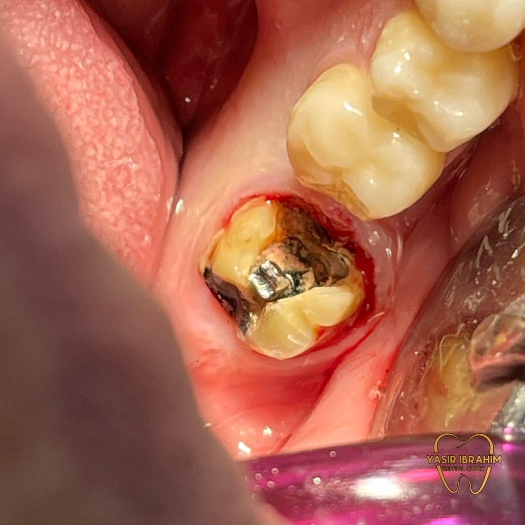 F0089AB9-C919-4129-B5B6-1CFA6213F758