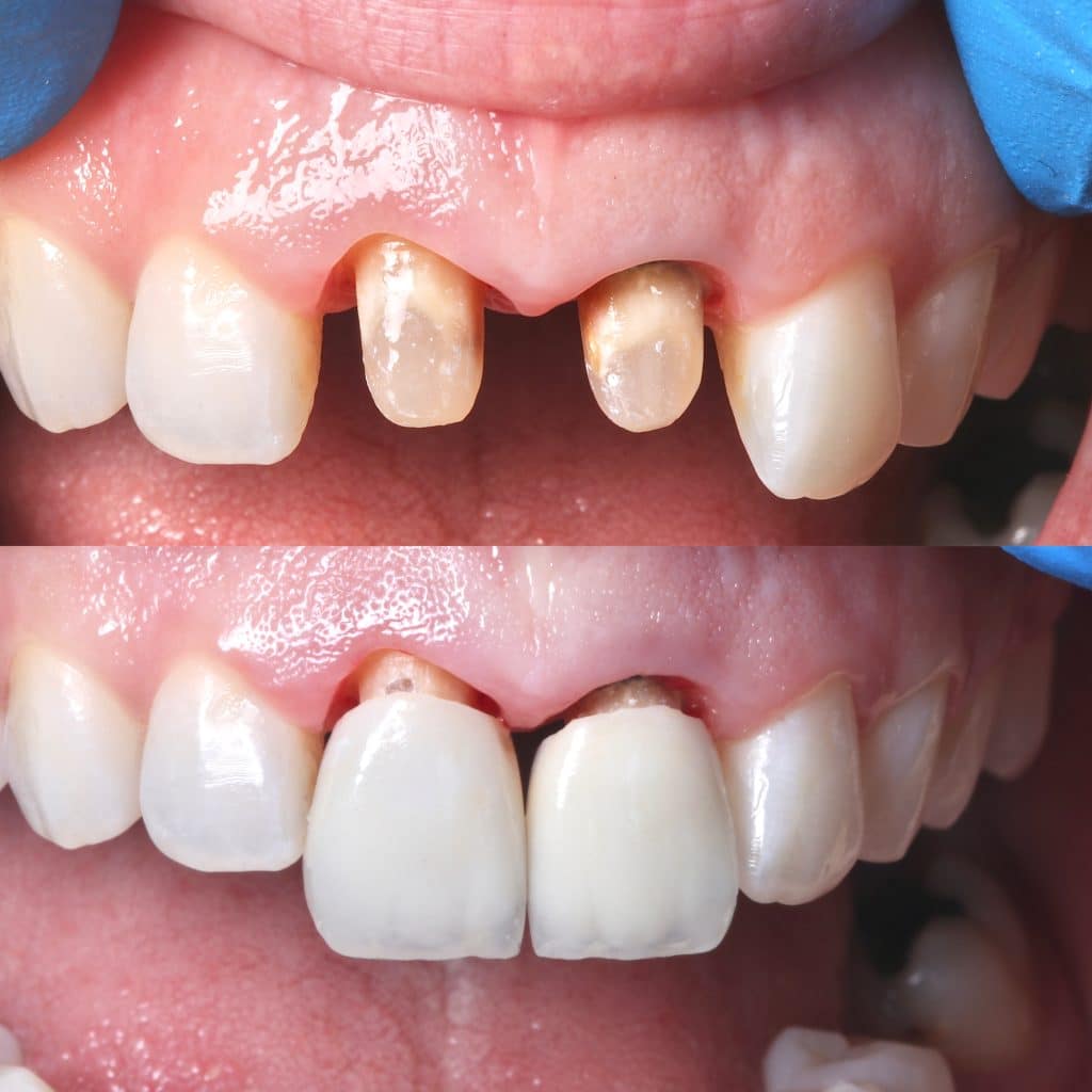 F2C6AEEF-2544-44B3-AF36-DFC0B746605D