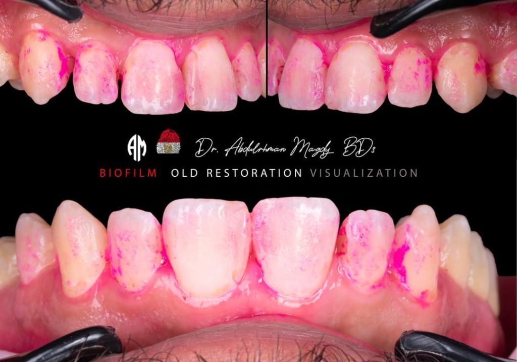 FB_IMG_1679817363186