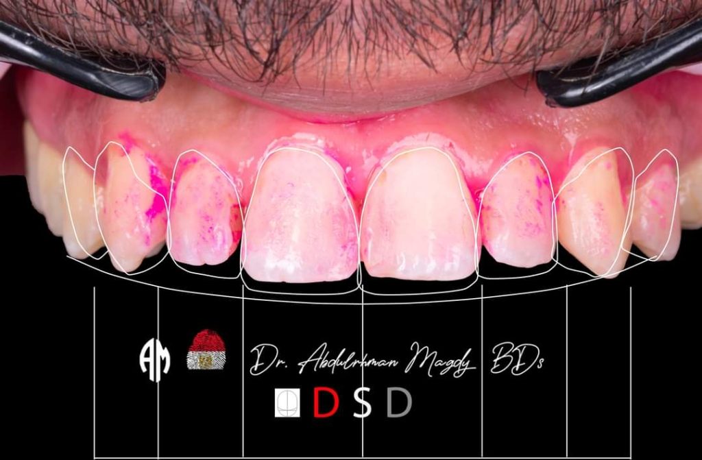 FB_IMG_1679817366813