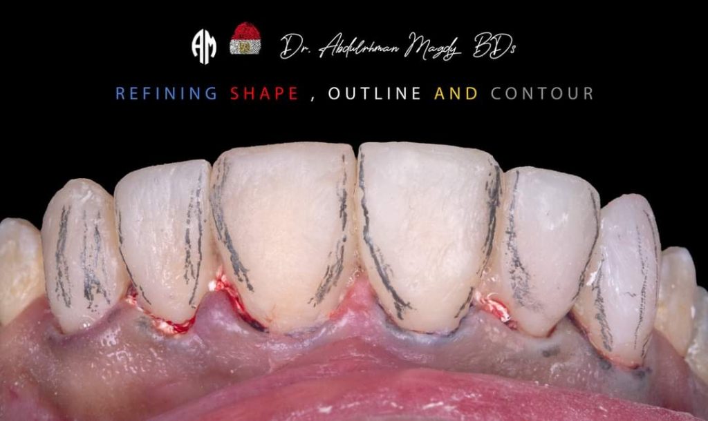 FB_IMG_1679817394387