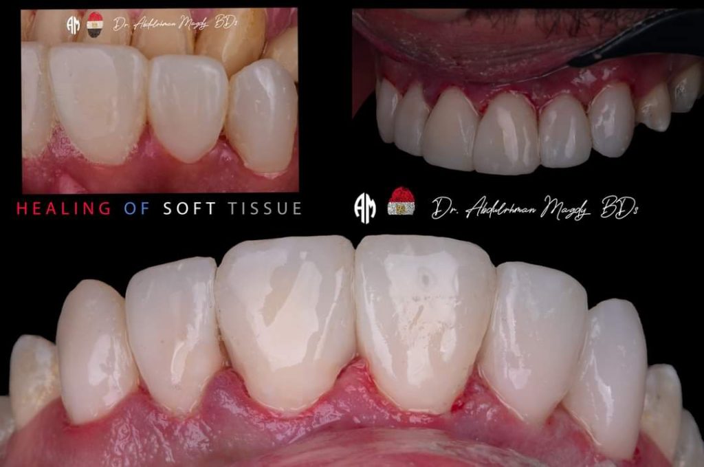 FB_IMG_1679817398354