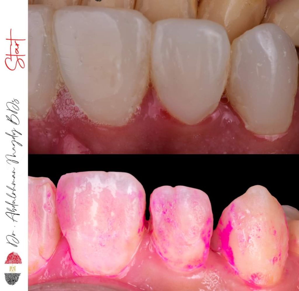 FB_IMG_1679817401430